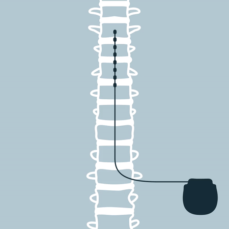 stimulator