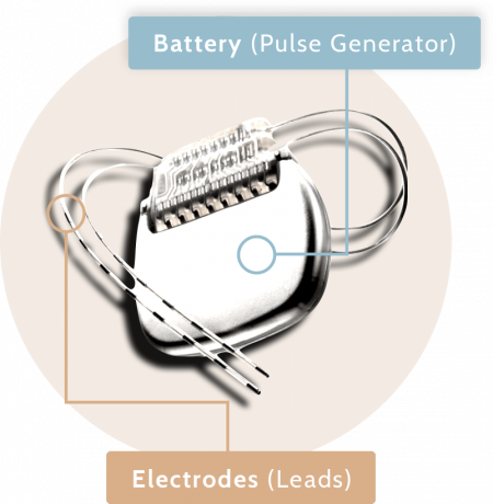 stimulator